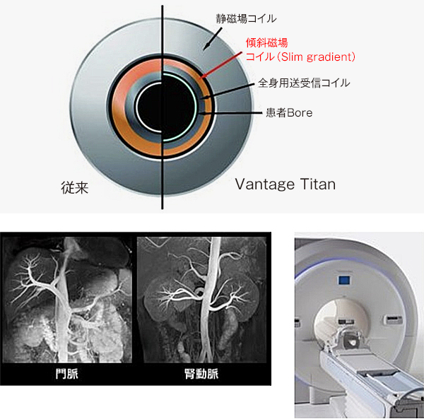MRI（東芝メディカルシステムズ社）
